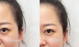 吃瓜能去眼袋吗,揭秘日常小零食的神奇功效