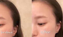 吃瓜能去眼袋吗,揭秘日常小零食的神奇功效