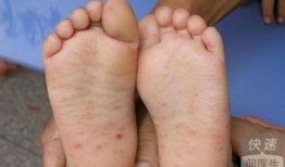 手足口可以吃瓜,夏日瓜果美味，健康防护不可少